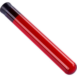 Refroidissement divers